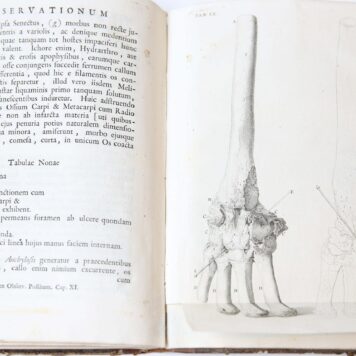 Observationum medico chirurgicarum fasciculus. Leiden, v.d. Eyk en v.d. Kluis, 1743, (20)+143 pp.