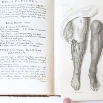Observationum medico chirurgicarum fasciculus. Leiden, v.d. Eyk en v.d. Kluis, 1743, (20)+143 pp.