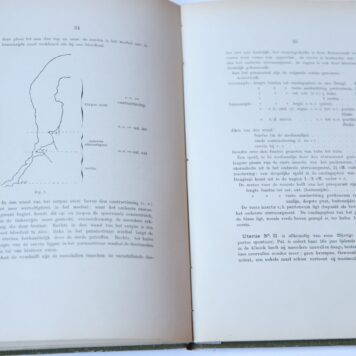 Bijdrage tot de kennis van het onderste uterussegment Leiden IJdo 1898.
