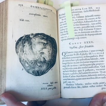Observationes medicae, editia nova libri quarto auction. Amsterdam, Elzevier, 1652. (16)+403 pp.